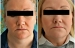 detail_979_Amanda_Cottingham_eyes-closed-before-and-after1.jpg